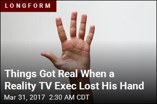 Things Got Real When a Reality TV Exec Lost His Hand