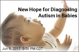 New Hope for Diagnosing Autism in Babies
