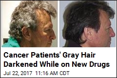 Cancer Patients&#39; Gray Hair Darkened While on New Drugs