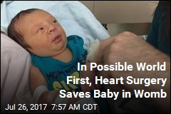 In Possible World First, Heart Surgery Saves Baby in Womb