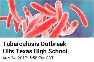 Tuberculosis Outbreak Hits Texas High School