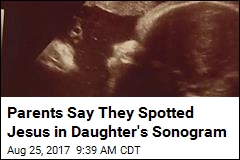Parents Say They Spotted Jesus in Daughter&#39;s Sonogram