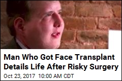Man Who Got Face Transplant Details Life After Risky Surgery