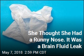 She Thought She Had a Runny Nose. It Was a Brain Fluid Leak