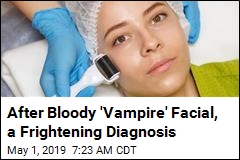 After Bloody &#39;Vampire&#39; Facial, a Frightening Diagnosis