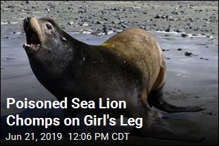 Poisoned Sea Lion Chomps on Girl&#39;s Leg