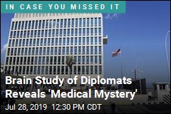 Brain Study of Diplomats Reveals &#39;Medical Mystery&#39;