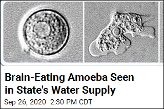 Texas Officials Issue Warning Over Brain-Eating Amoeba