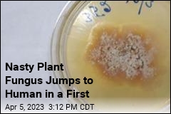 Nasty Plant Fungus Jumps to Human in a First