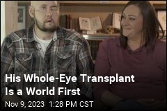 His Whole-Eye Transplant Is a World First