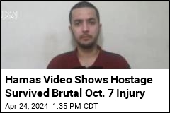 Hamas Video Shows Hostage Survived Brutal Oct. 7 Injury