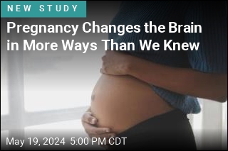 Pregnancy Changes the Brain in More Ways Than We Knew