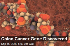 Colon Cancer Gene Discovered
