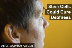 Stem Cells Could Cure Deafness