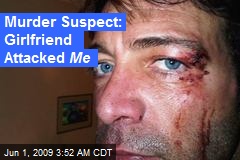 Murder Suspect: Girlfriend Attacked Me