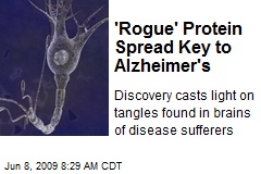 'Rogue' Protein Spread Key to Alzheimer's