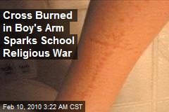 Cross Burned in Boy's Arm Sparks School Religious War