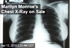 Marilyn Monroe's Chest X-Ray on Sale