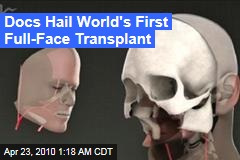 Docs Hail World's First Full-Face Transplant