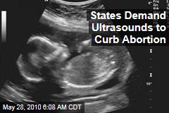 States Demand Ultrasounds to Curb Abortion