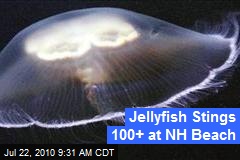 Jellyfish Stings 100+ at NH Beach