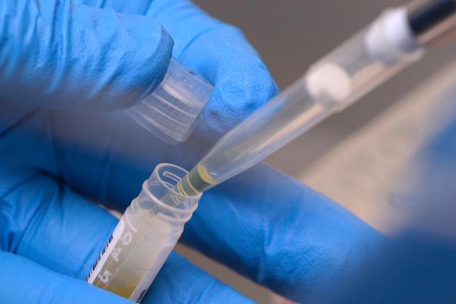 NIH funding cuts have affected over 74,000 people enrolled in experiments, a new report says