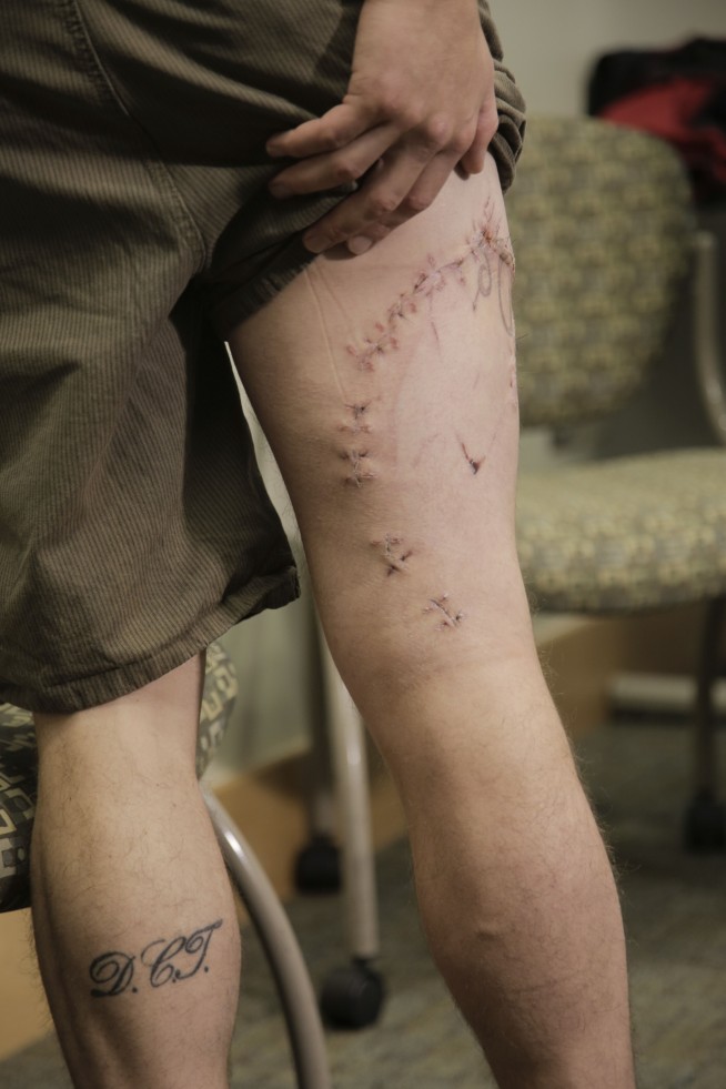 Oregon surfer punched shark in gills to survive