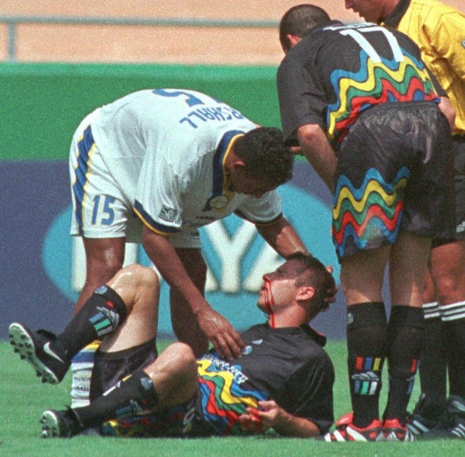 CTE diagnosed in ex-MLS player Vermillion, a 1st for league