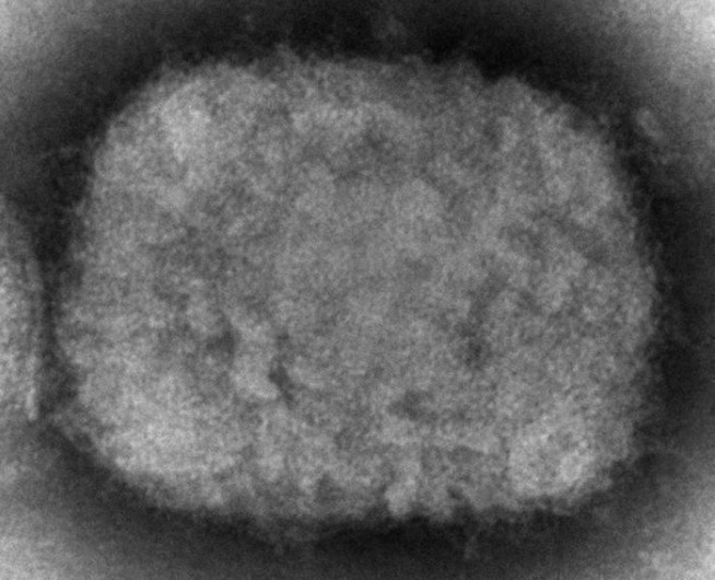 UN health agency chief declares monkeypox a global emergency