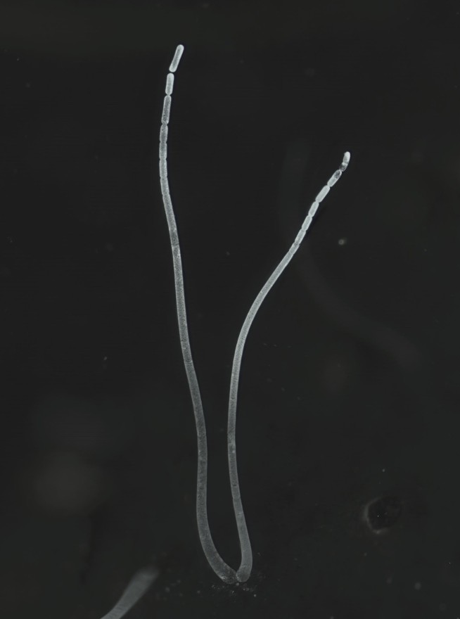 World's biggest bacterium found in Caribbean mangrove swamp