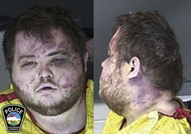 Colorado gay club shooting suspect charged with hate crimes