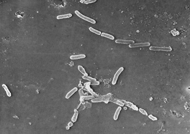 More deaths, injuries linked to recalled eyedrops