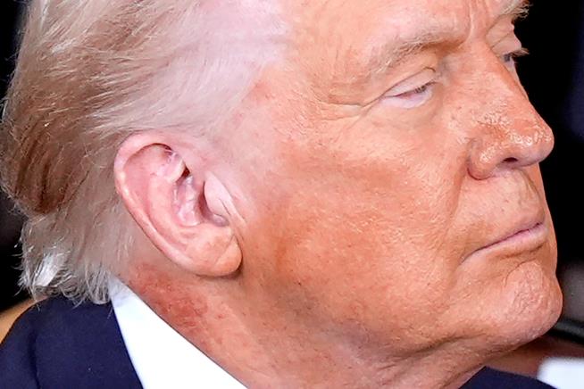 White House attributes redness on Trump's neck to skin cream but doesn't say what it's treating