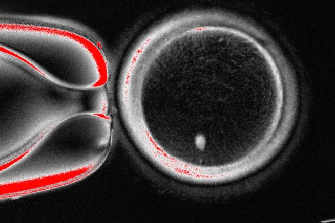 Researchers turn human skin cells into eggs — but not yet usable ones