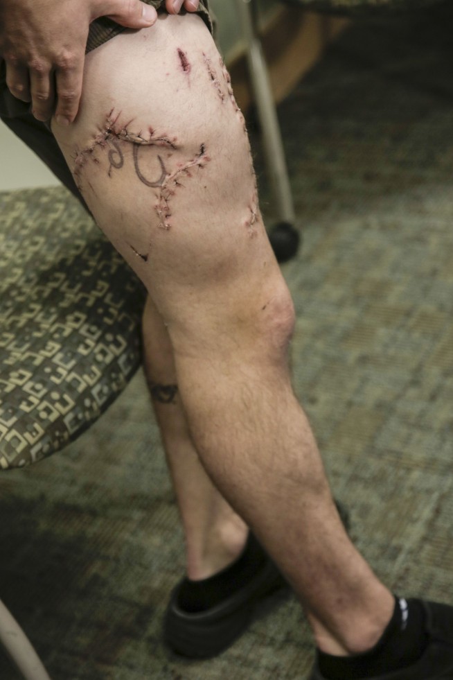 Oregon surfer punched shark in gills to survive