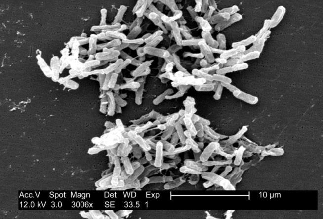 New Superbug Highlights Poor Hospital Hygiene