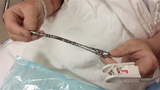 51 Years Later, Turn Signal Lever Removed From Guy's Arm