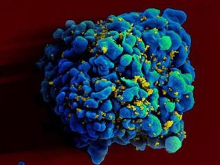 'Sweet Tooth' May Be 'Achilles Heel' of HIV