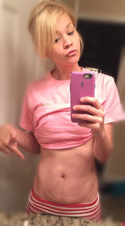 Mom's Honest Pic of 'Perfect' Post-Baby Body Goes Viral