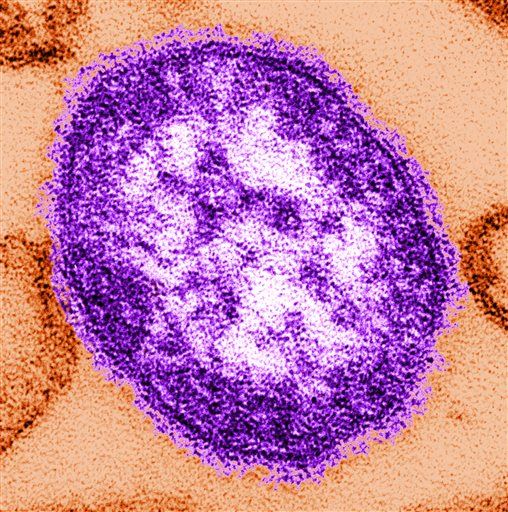 US Has First Measles Death in 12 Years
