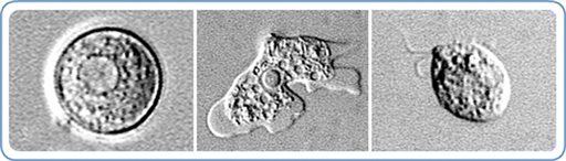 Brain-Eating Amoeba Claims Another Young Victim