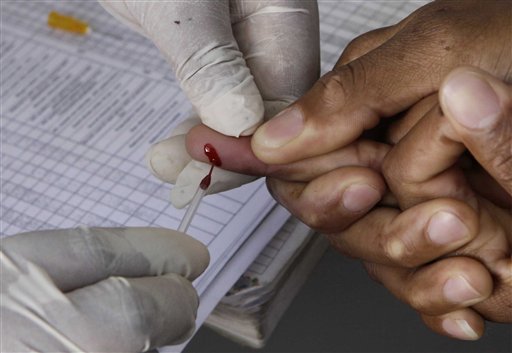UN Makes Dramatic Change to HIV Advice