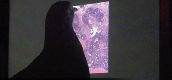 Pigeons Quickly Learn to Read Mammograms