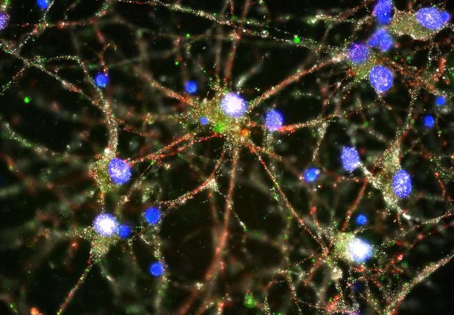 New Study Is 'Crucial Turning Point' in Battle Against Schizophrenia