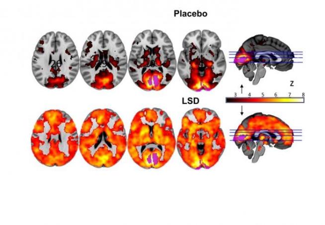 Scientists Wowed by First Look at Brain on LSD