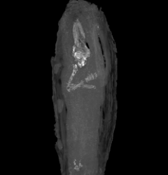 Preserved Fetus Is Likely Youngest Egyptian Mummy