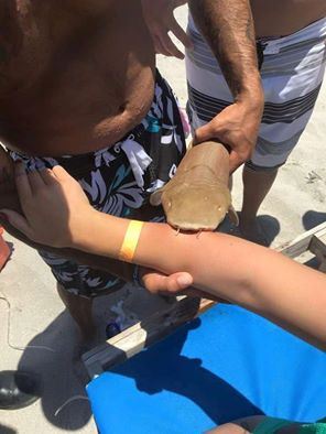 Bite Victim Hospitalized With Shark Still Attached