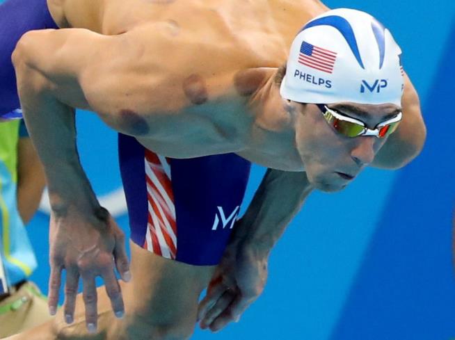 No, Those Aren't Hickeys on Olympic Athletes
