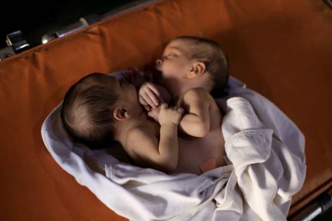 Conjoined Twins in Syria Die While Awaiting Evacuation