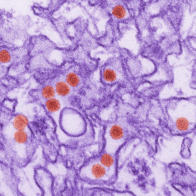 Another Strange Zika First Reported